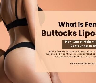 What is Female Buttocks Liposuction