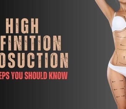 High definition Liposuction: 3 key steps you should know before Surgery