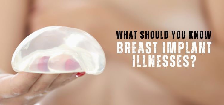 What Should You Know About Breast Implant Illnesses What Should You Know About Breast Implant Illnesses