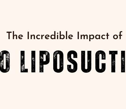 The Incredible Impact of 360-Degree Liposuction