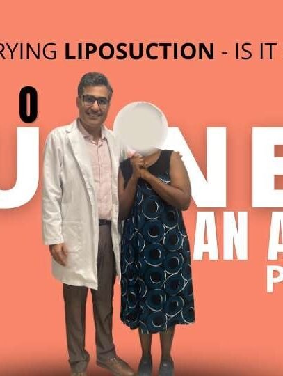 Trying Liposuction - Is It Safe