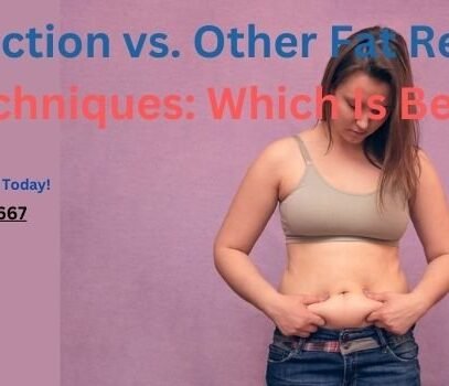 Liposuction vs. Other Fat Removal Techniques Which Is Best