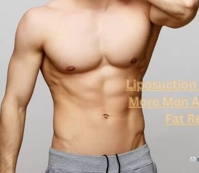 Liposuction for Men: Why More Men Are Opting for Fat Removal