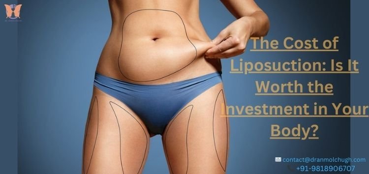 The Cost of Liposuction Is It Worth the Investment in Your Body The Cost of Liposuction: Is It Worth the Investment in Your Body?