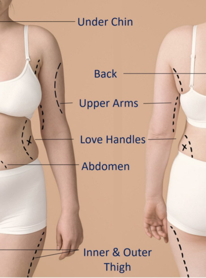 Comparing fat removal surgery and liposuction procedures