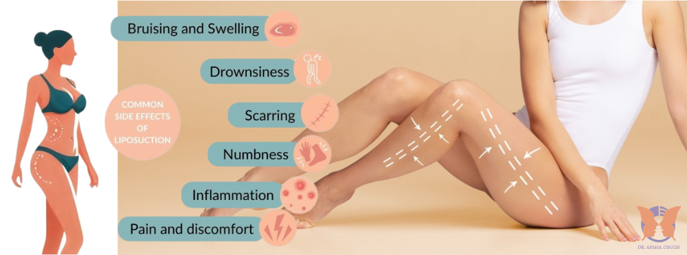 Thigh liposuction recovery process and side effects Thigh liposuction recovery process and side effects