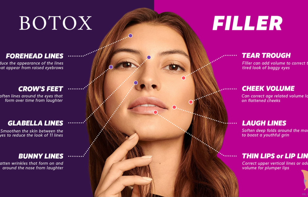 Comparison between fillers and Botox for facial rejuvenation and wrinkle reduction