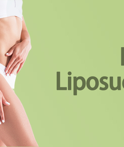 Laser liposuction for stomach – Effective fat removal and body contouring