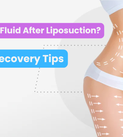 Managing fluid retention after liposuction – Recovery tips for reduced swelling