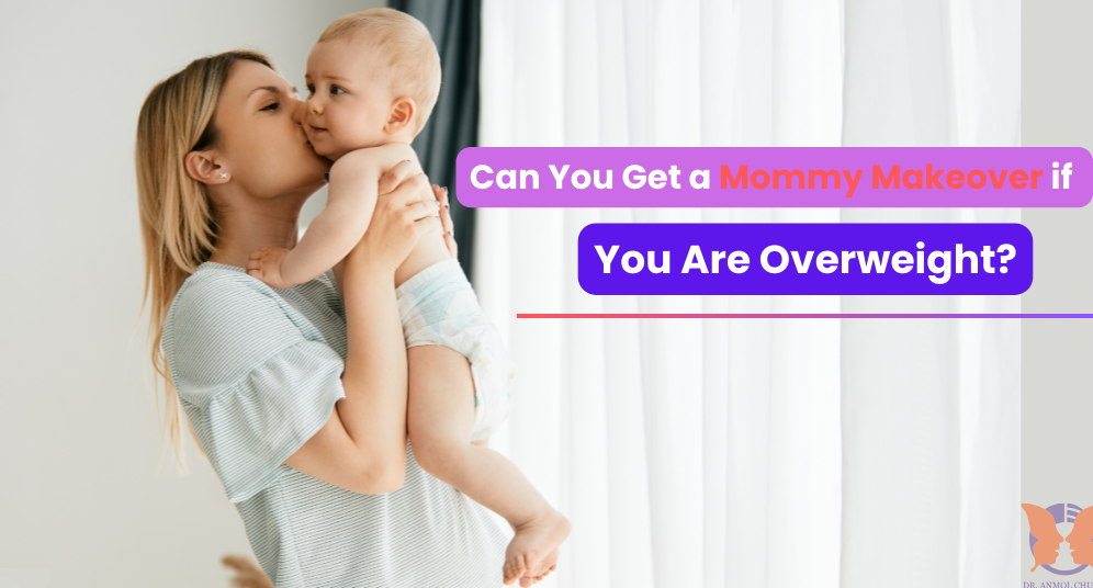 Mommy makeover results for overweight women – Before and after transformation